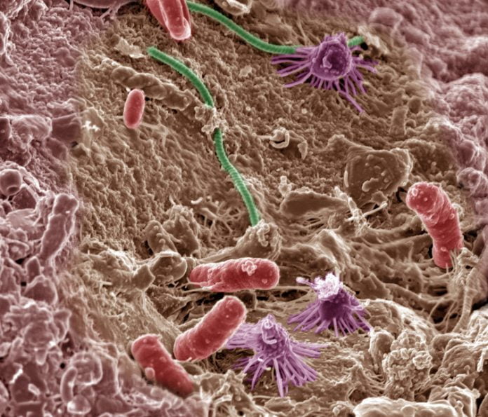 microbe