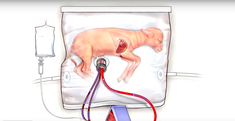 womb