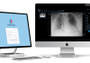 Artificial intelligence PadiMedical system, accelerates patient critical data sharing