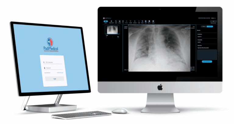 PadiMedical-System-replaces-the-manual-film-or-CD-method-and-acts-as-a-Supplementary-CloudPACS-with-the-integration-of-Artificial-Intelligence-to-accelerate-the-patient-critic