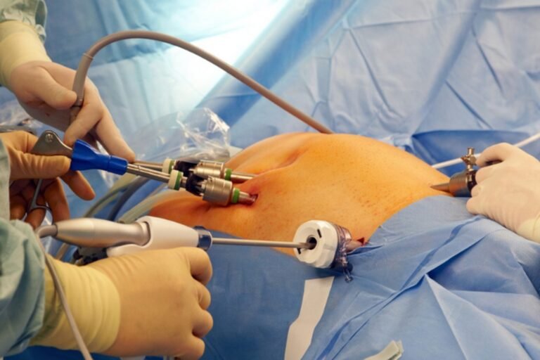 laparoscopic_surgery_1600x1067